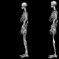 squelettecoupdepiedaucul