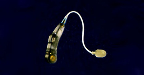 09339126_PVI_0001_GA_04